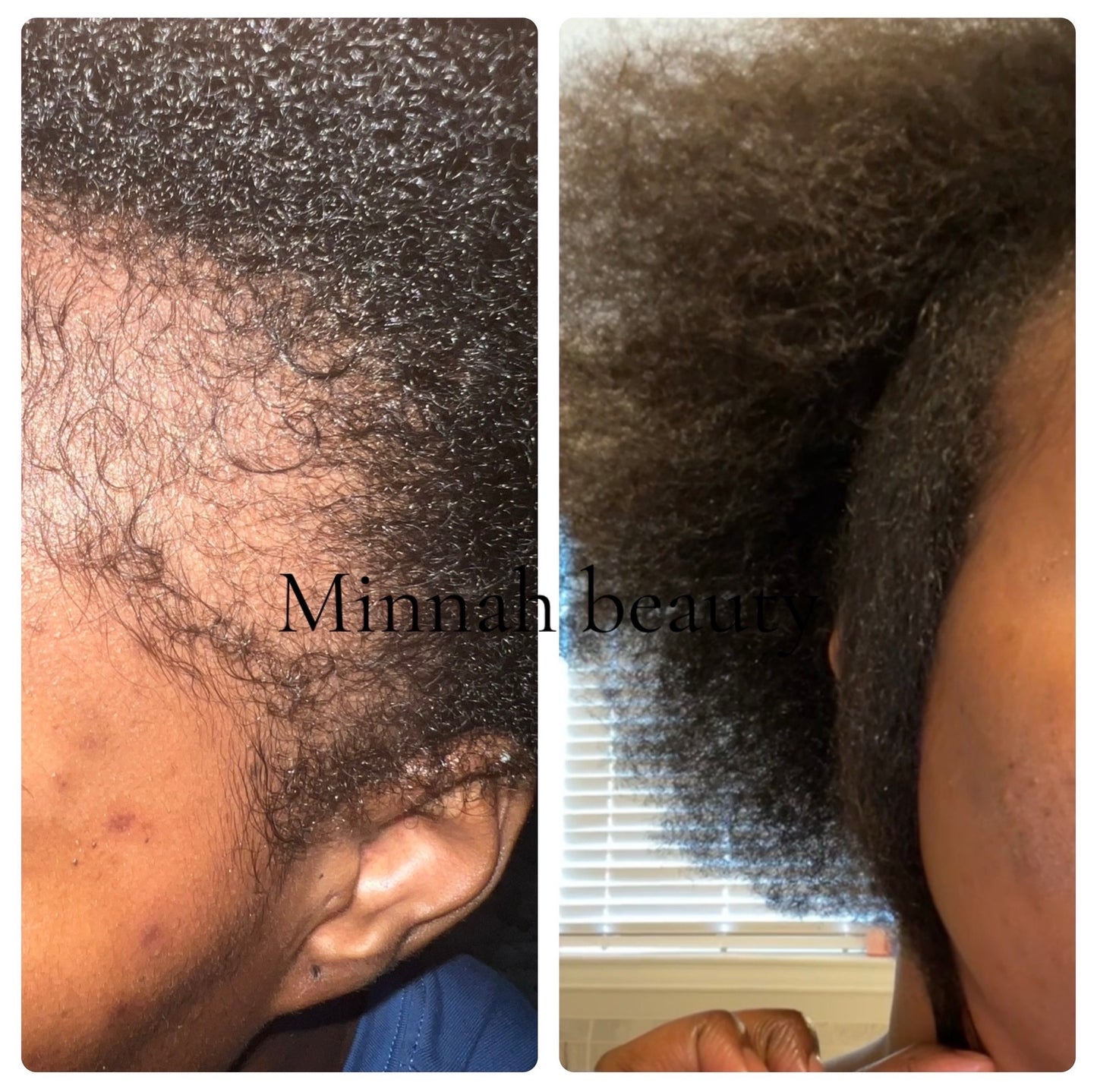 Mini Herbal Hair Growth Oil