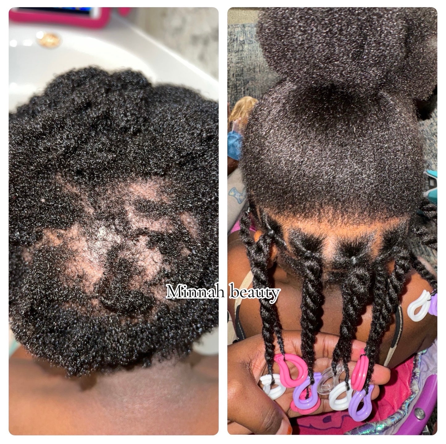 Mini Herbal Hair Growth Oil